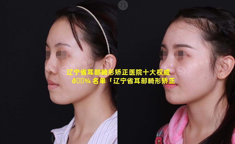 辽宁省耳部畸形矫正医院十大权威 🌾 名单「辽宁省耳部畸形矫正医院十大权威名单图片」